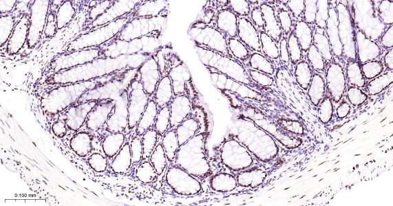 Tar DNA 结合蛋白43即用型免疫组化试剂盒-IHC0429